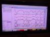 147 - 20140417 F3RS Stage1