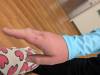 202 - 20241208 Starry Night Octopus Bite Hand