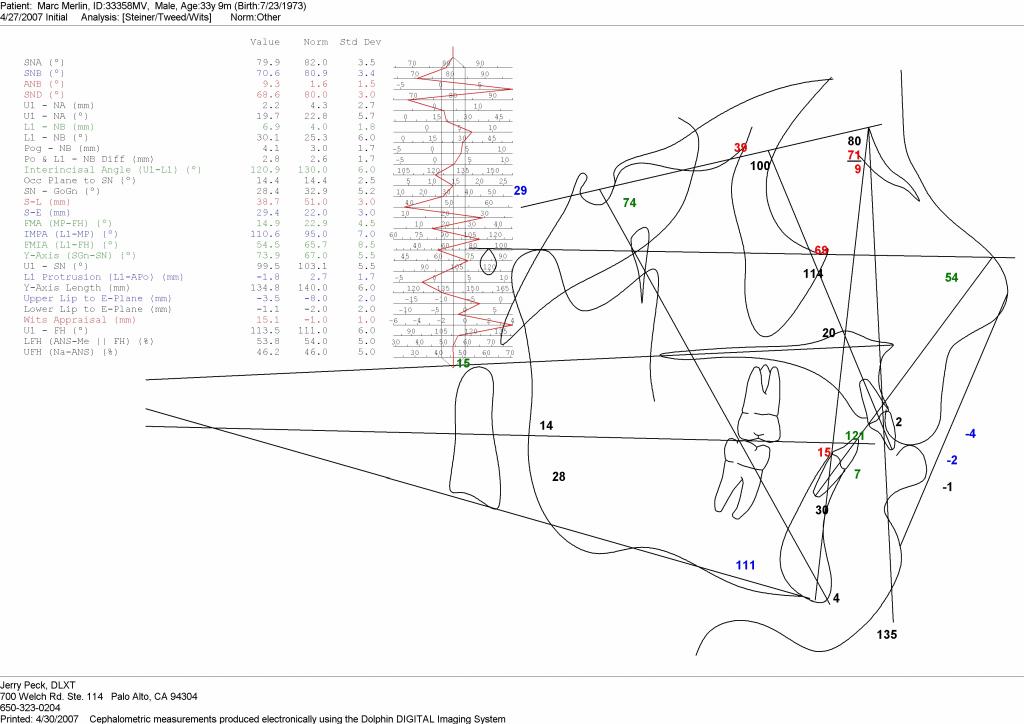 101 - tracing