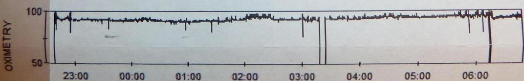 412 - Stanford Report SPO2