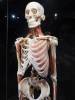 208 - 20191016 Amsterdam Body World