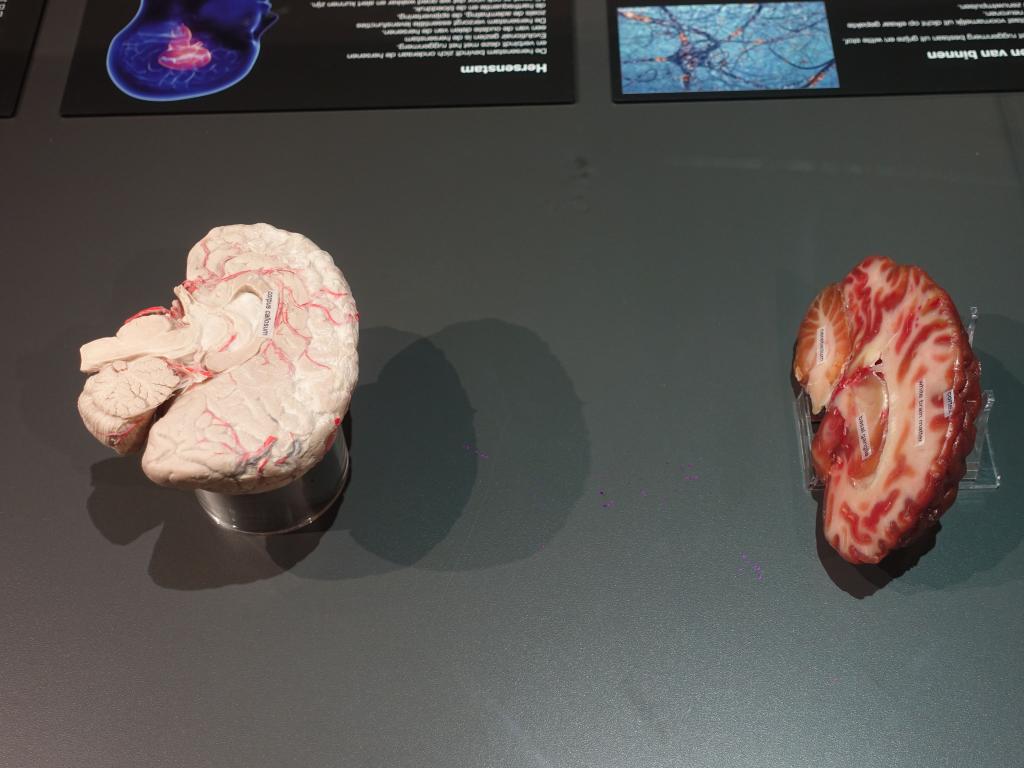 200 - 20191016 Amsterdam Body World