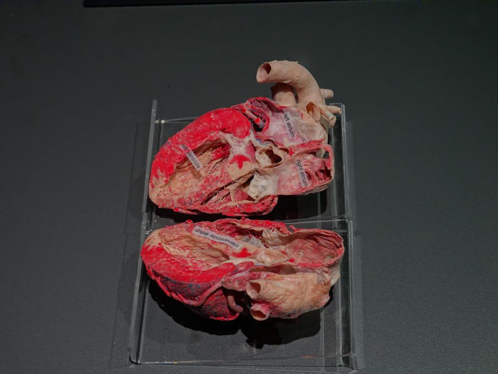 215 - 20191016 Amsterdam Body World