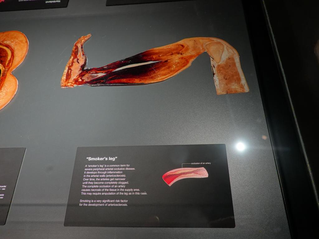 216 - 20191016 Amsterdam Body World