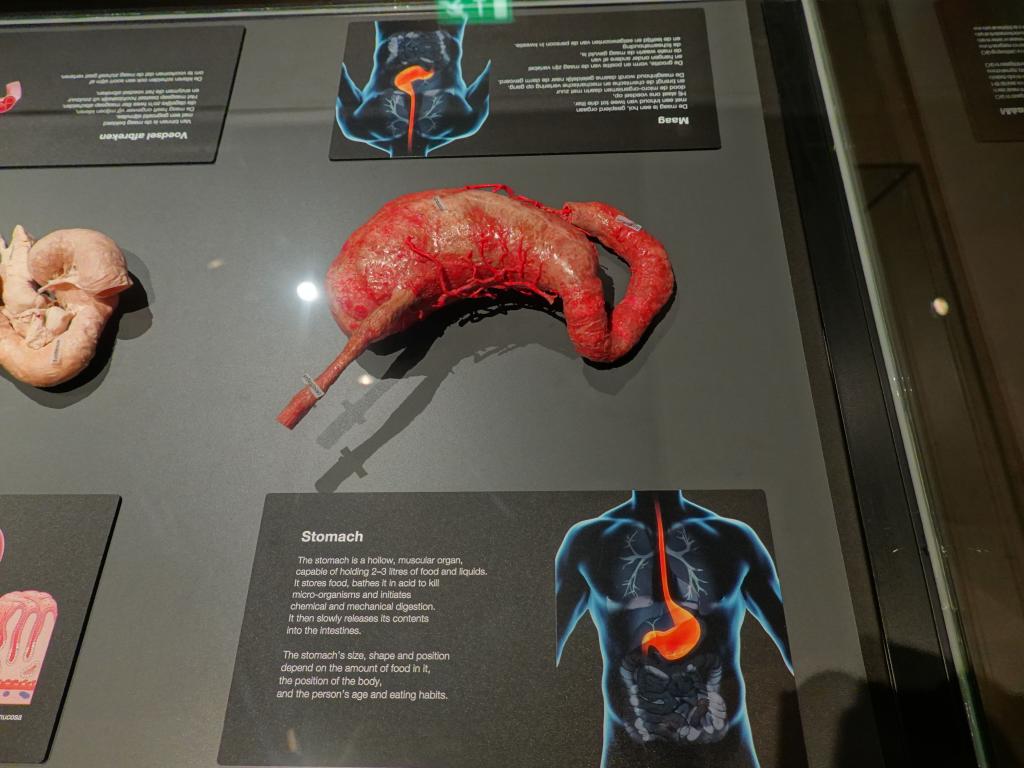 224 - 20191016 Amsterdam Body World