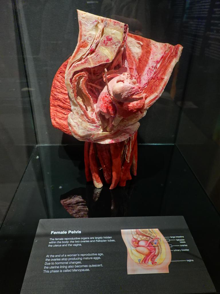 231 - 20191016 Amsterdam Body World