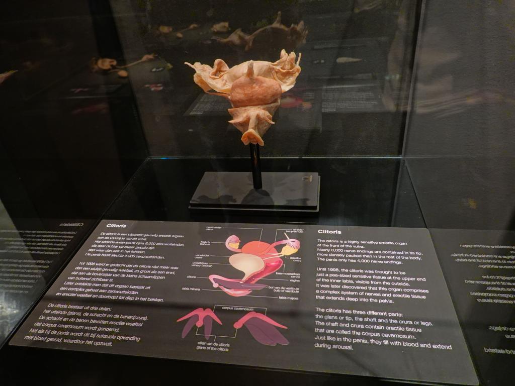 232 - 20191016 Amsterdam Body World