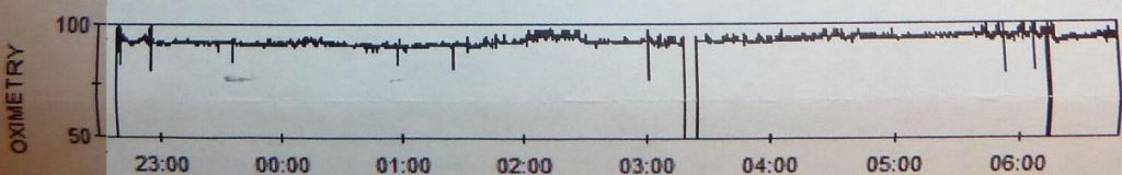 Stanford graph